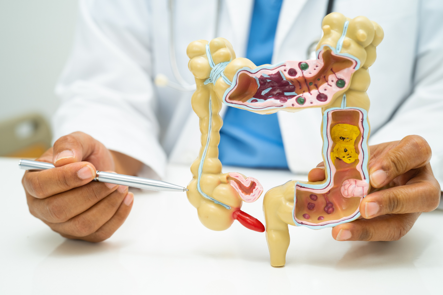 Colorectal Cancer Screening Without a Colonoscopy: Is the Shield Blood Test Right for You?