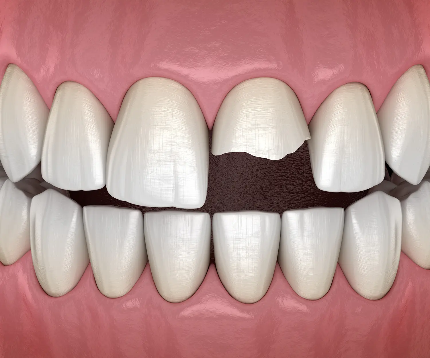 Emergency Dentist in Oklahoma City, OK | Magnolia Dental Center