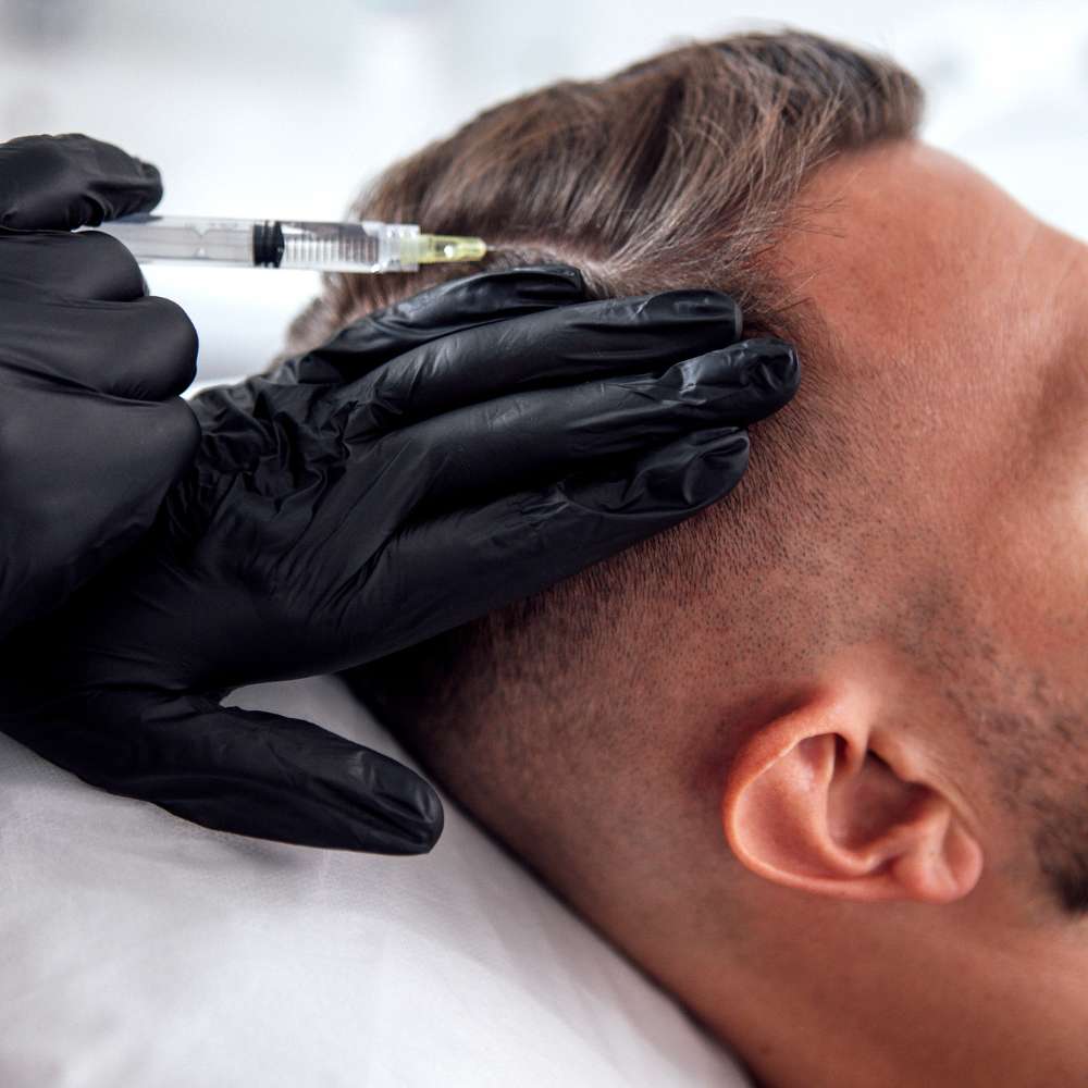 Close-up of a provider performing a scalp stimulation hair restoration therapy at Fanous Medspa in Charlotte, North Carolina.