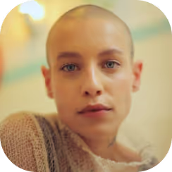 young bald white woman