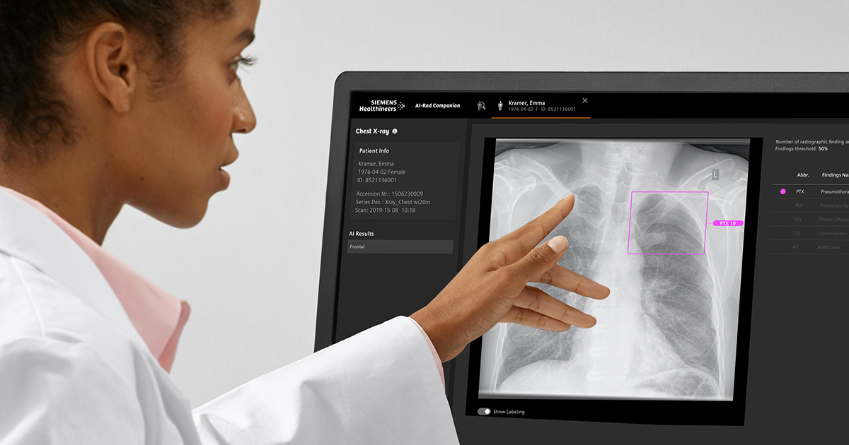 Ärztin analysiert MRT mit KI-Unterstützung.