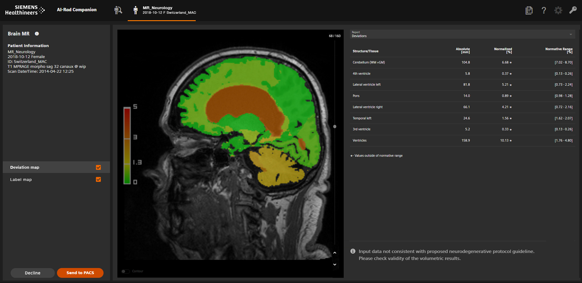 Bildschirm mit Ansicht eines grünen seitlichen Kopf-MRTs in AI-Rad Companion Software.