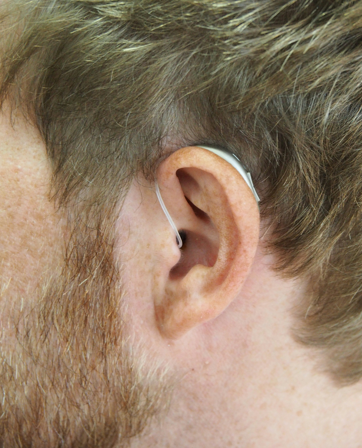 Seitliche Ansicht eines Ohrs mit Hörgerät.
