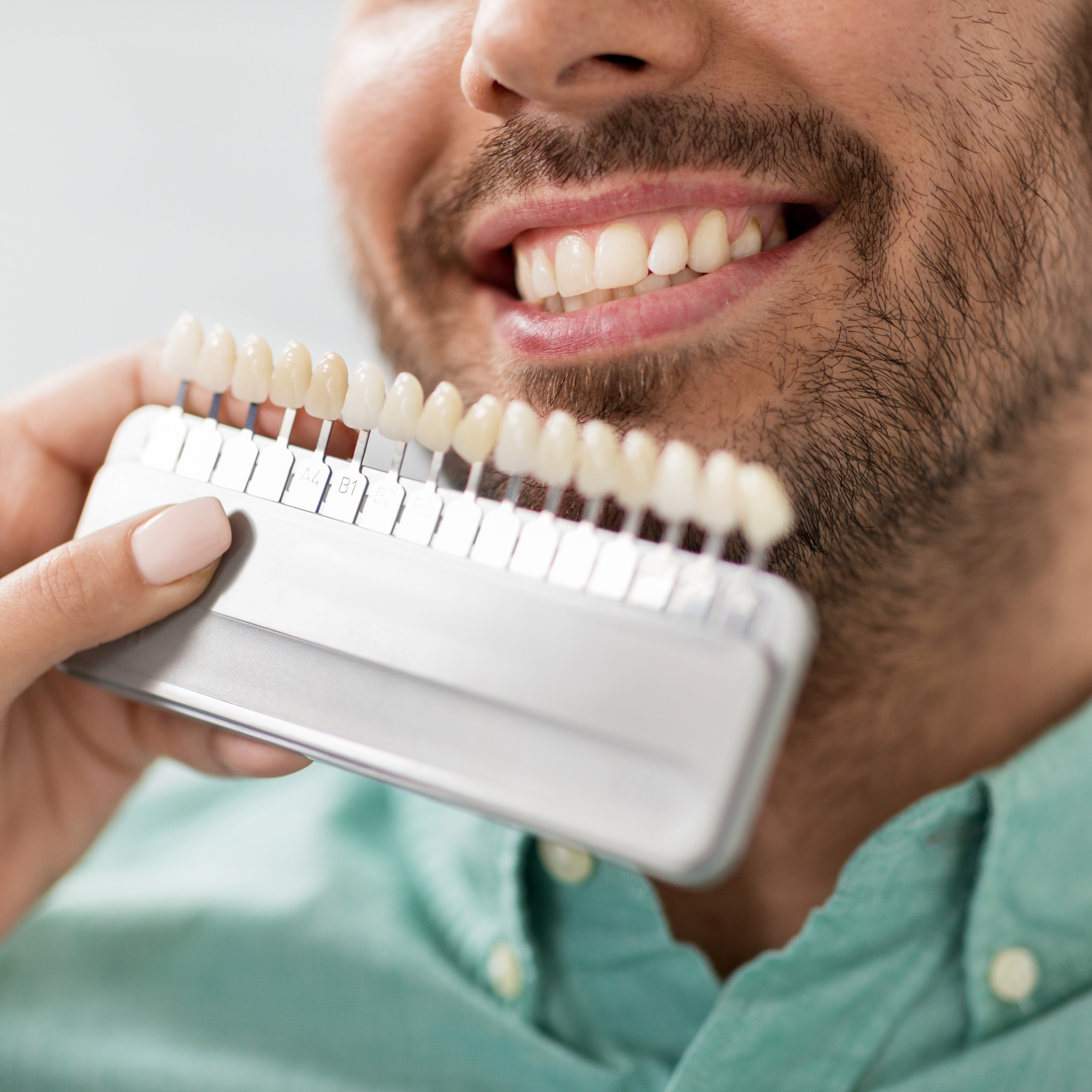 Sanfte Power für dein Lächeln – modernste Whitening-Technologie bei Blanco Bleaching