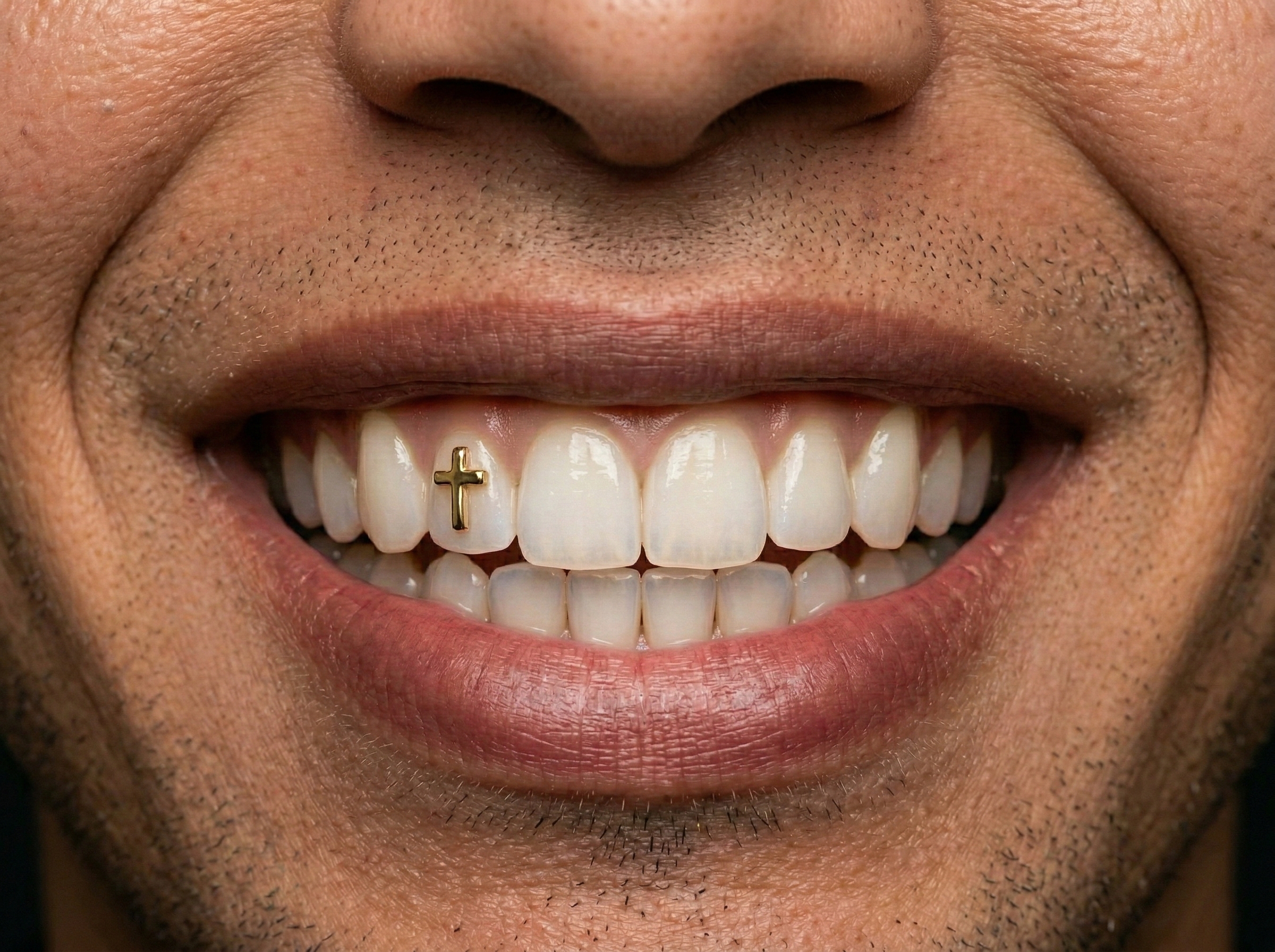 Zahnschmuck in Stuttgart – Tooth Gem von Blanco Bleaching