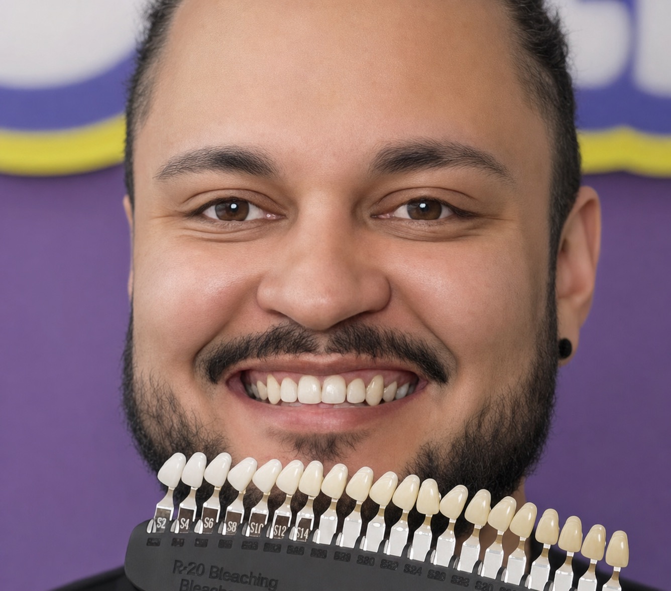 Nachher
