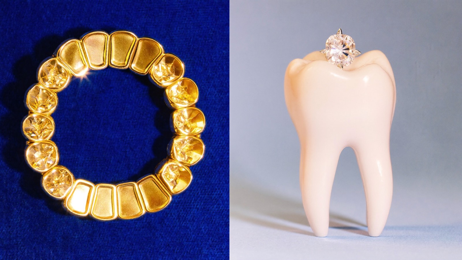 Grillz vs. Tooth Gems: Der Unterschied erklärt