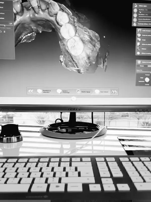 Spécialisation en CFAO, au laboratoire Dental Technique Berger à Marly, 2018/ 2019. 