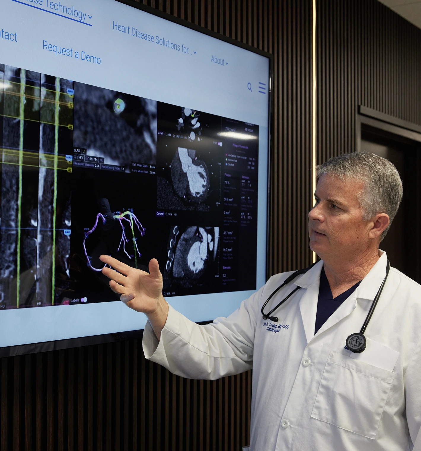 Male cardiologist pointing at heart scan images displayed on a large monitor.