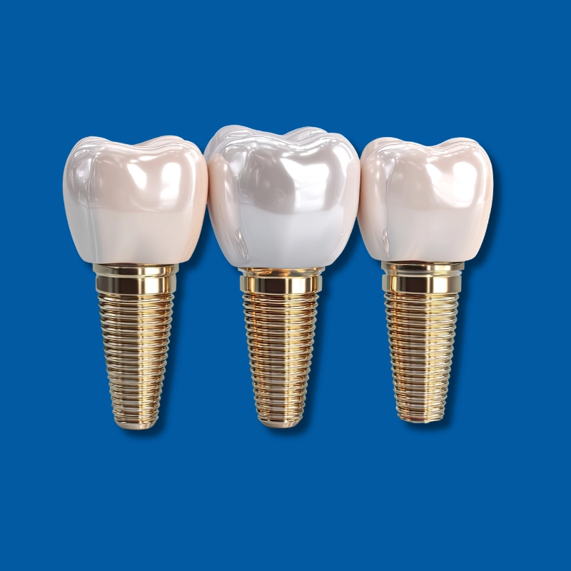 Complimentary Dental Implant Consultation | Save $400