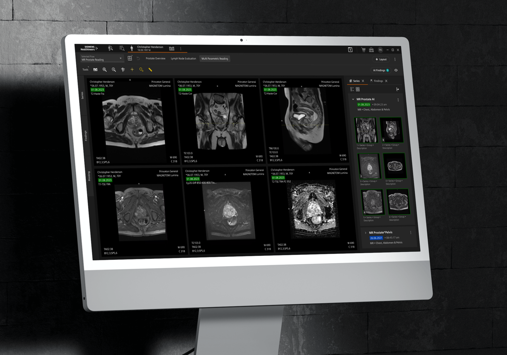 Siemens Healthineers