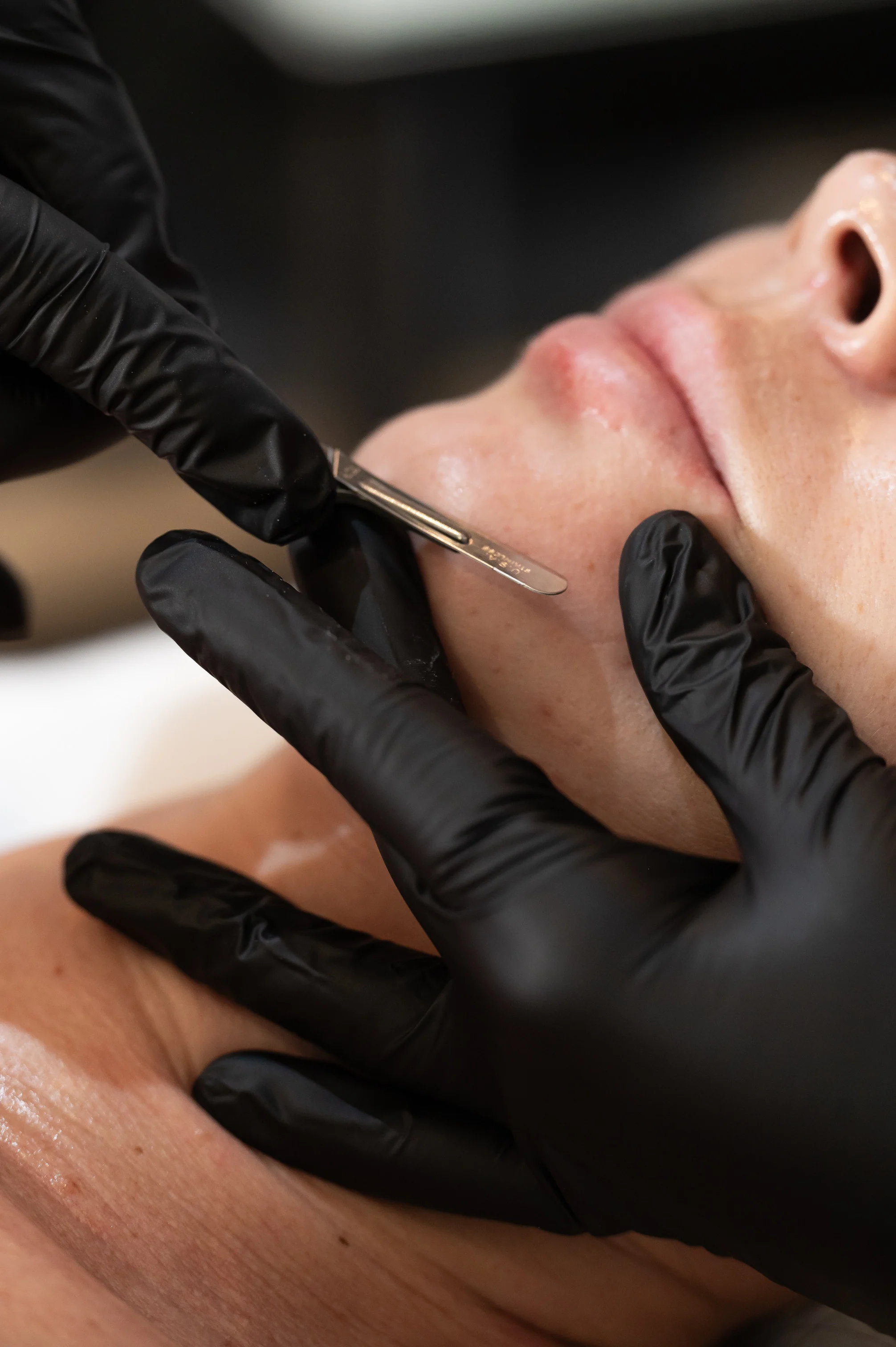 facial therapy session 