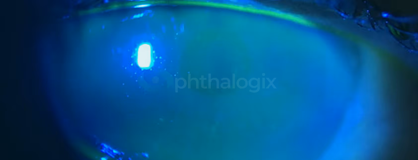 Right eye stained w/ fluorescein on Day 3 — initial defects resolved, tear film normal