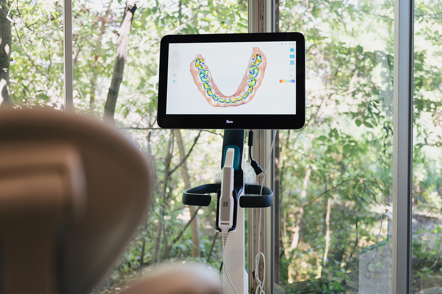 Dental scanner machine with a screen displaying a digital model of lower teeth.