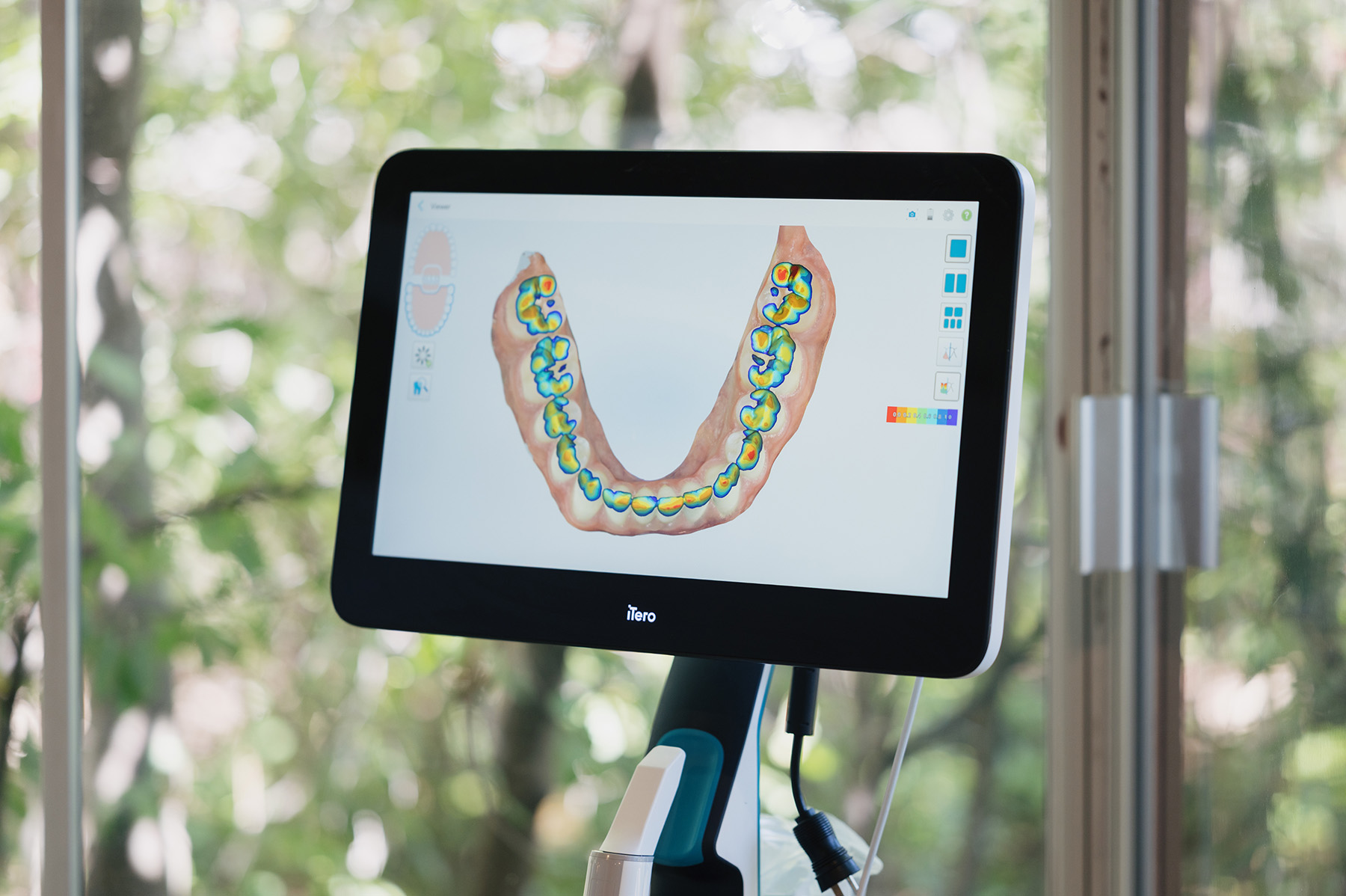 Digital dental scan of lower teeth on iTero screen showing a color-coded topographic map.