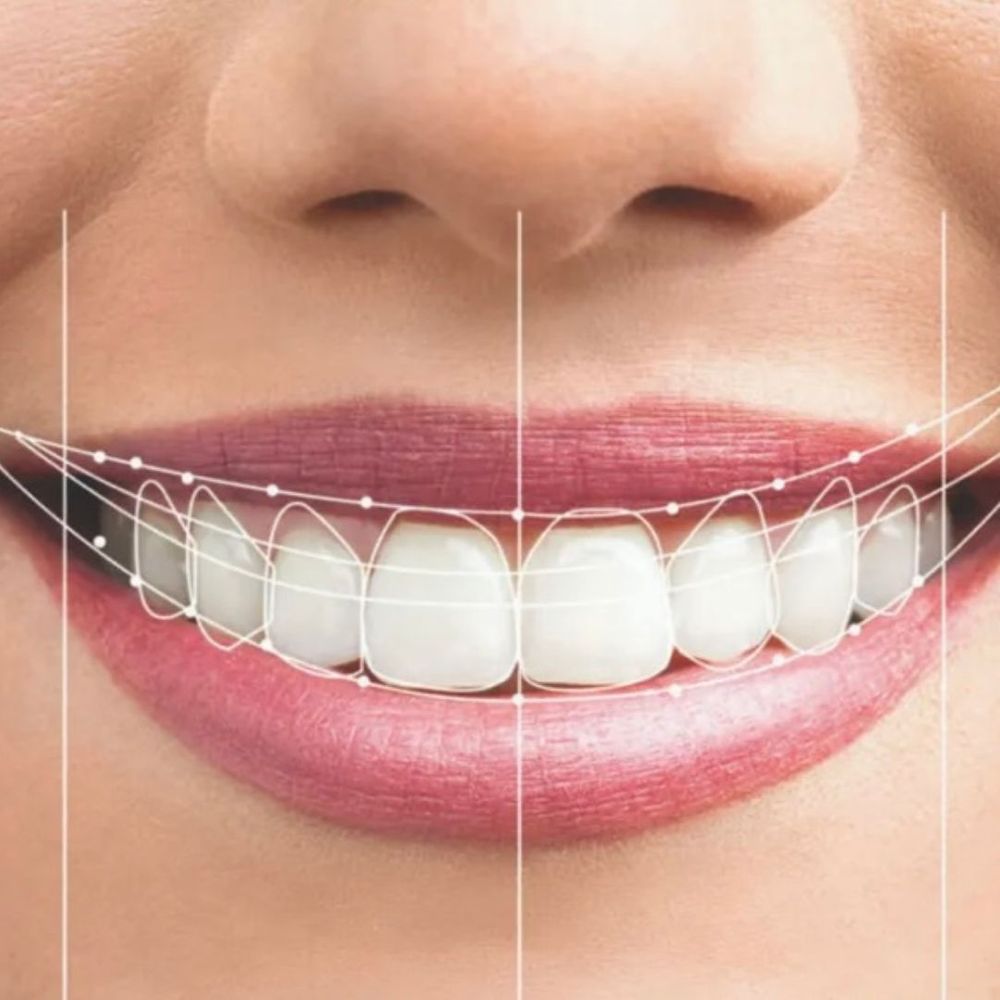 graphic of healthy teeth