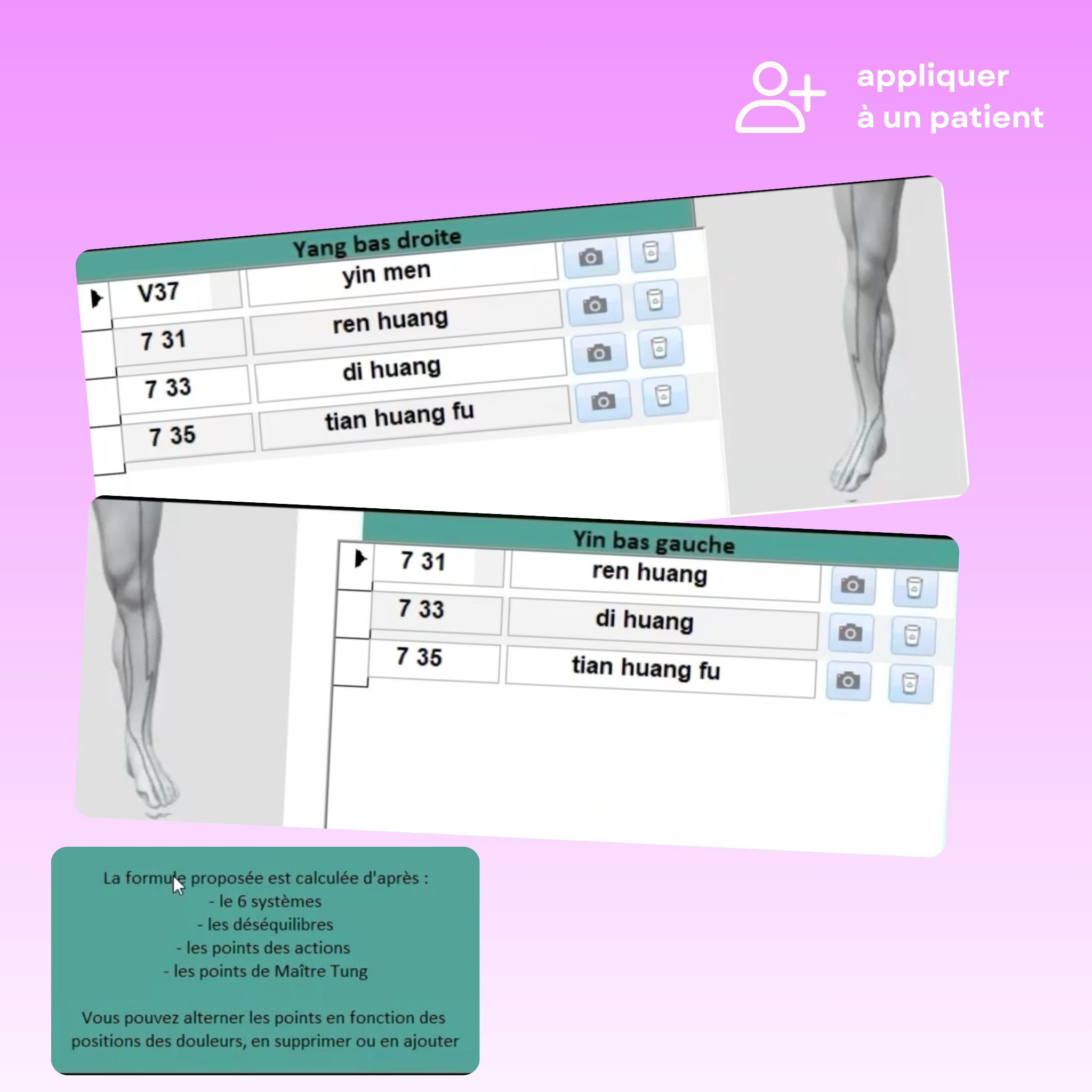 Interface montrant le résultat d'une formule d'acupuncture, la liste des éléments utilisés pour calculer cette formule et la fonction "ajouter à un patient".