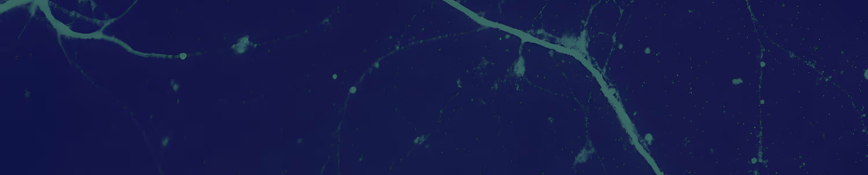 Close-up of dark blue and green tangled fibers or neural-like network on a dark background.