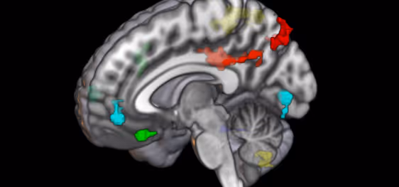 A Sagittal, post-mortem scan of the brain with relevant regions highlighted