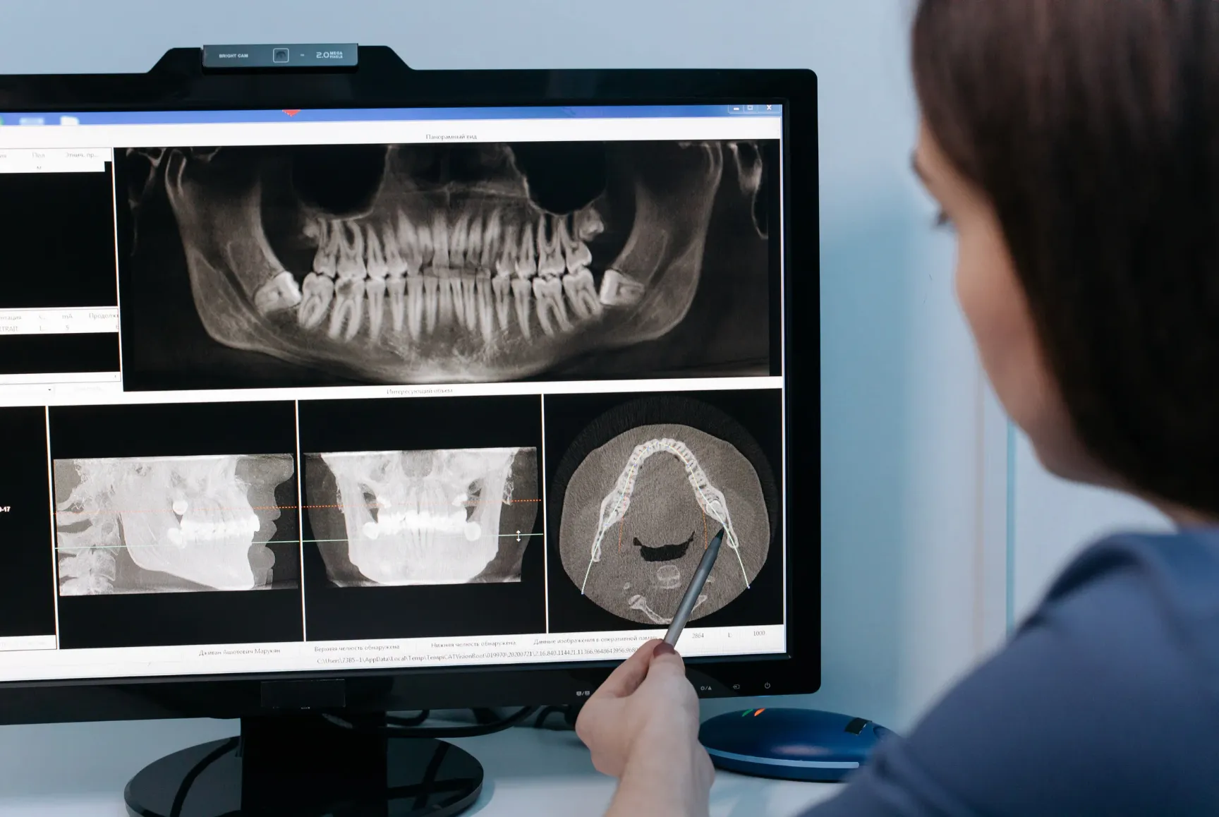 Clinicienne examinant des images radiographiques dentaires numériques à l'écran