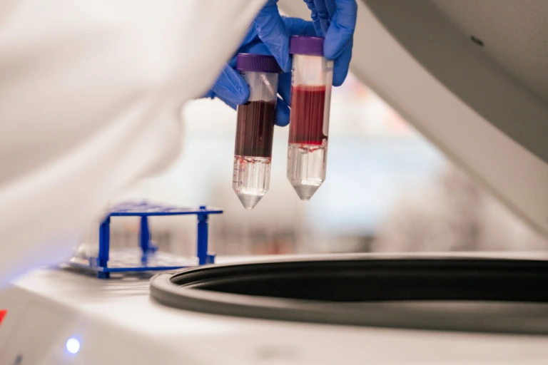Person wearing blue gloves holding two blood sample tubes near a centrifuge machine.