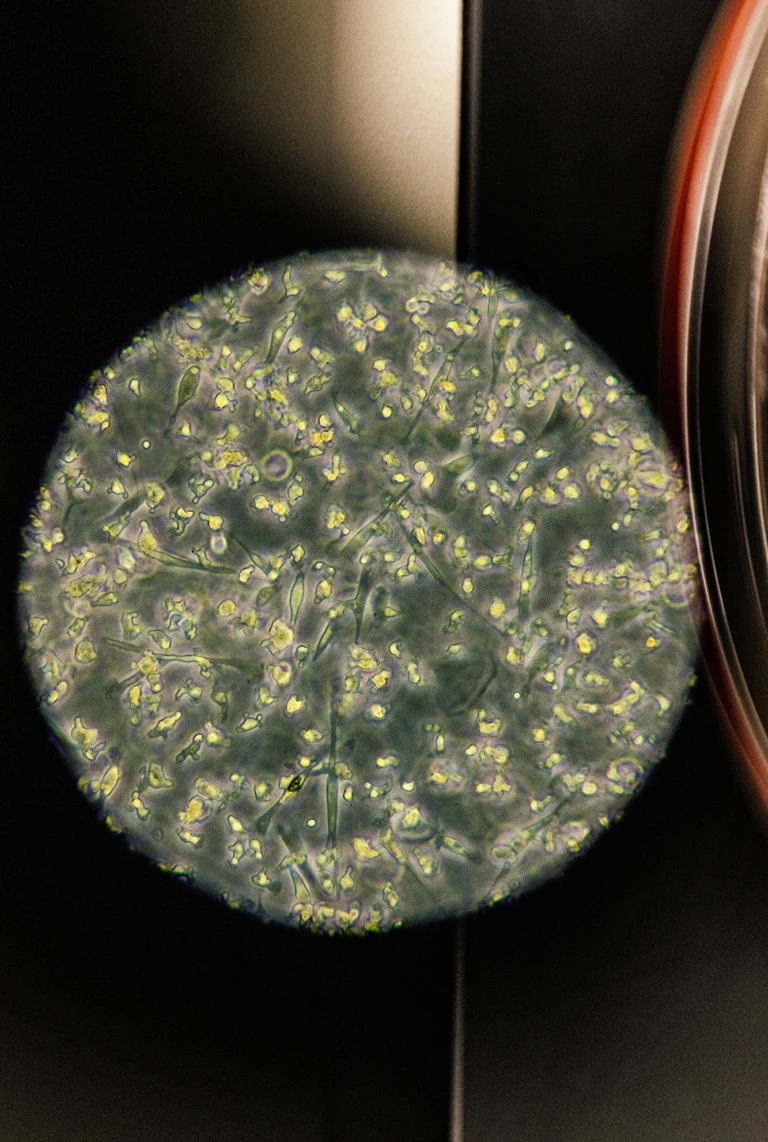 Microscopic view showing numerous small, irregularly shaped yellow-green cells on a dark background.
