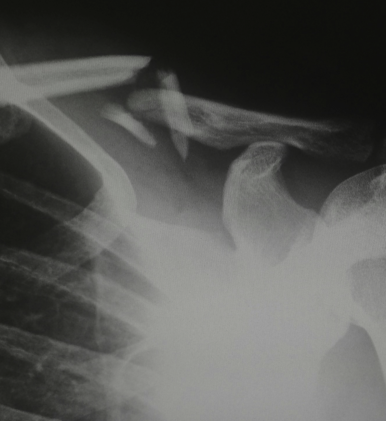Police officer writing a report beside a car.