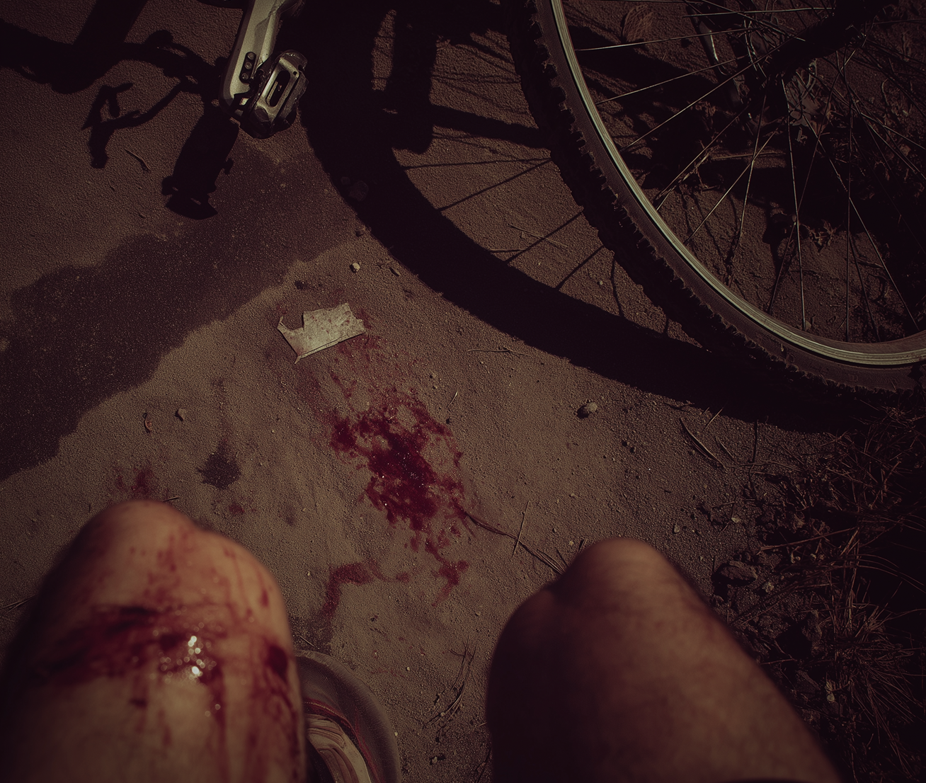 Woman holding her neck while looking at her phone near a car accident.