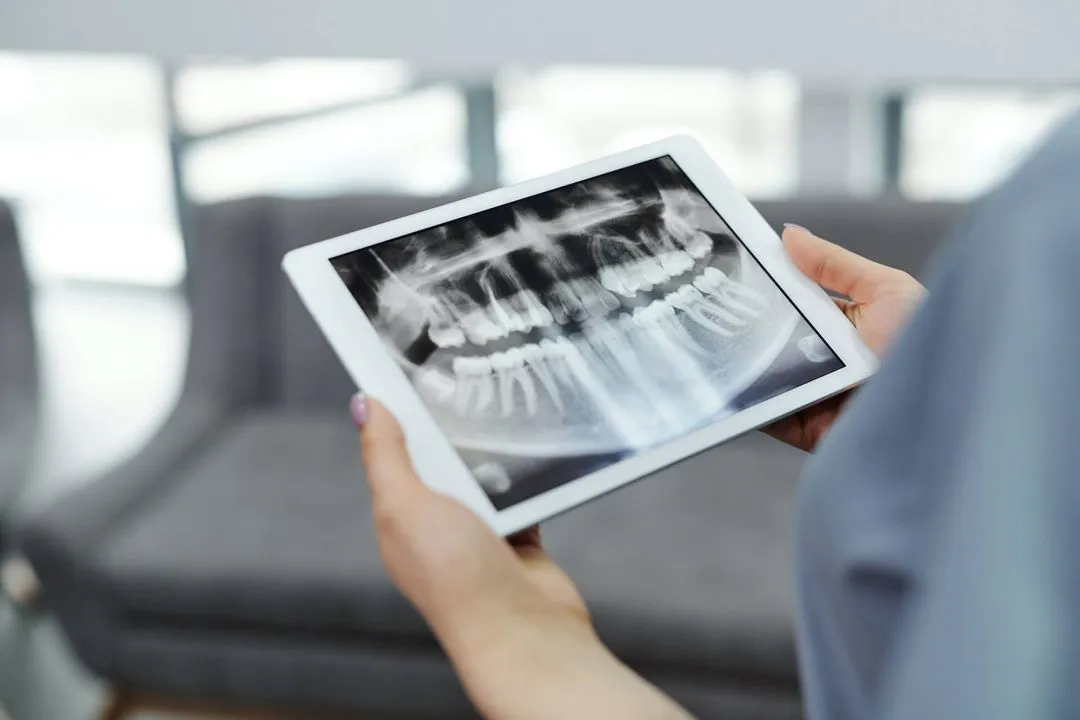 Teeth Straightening