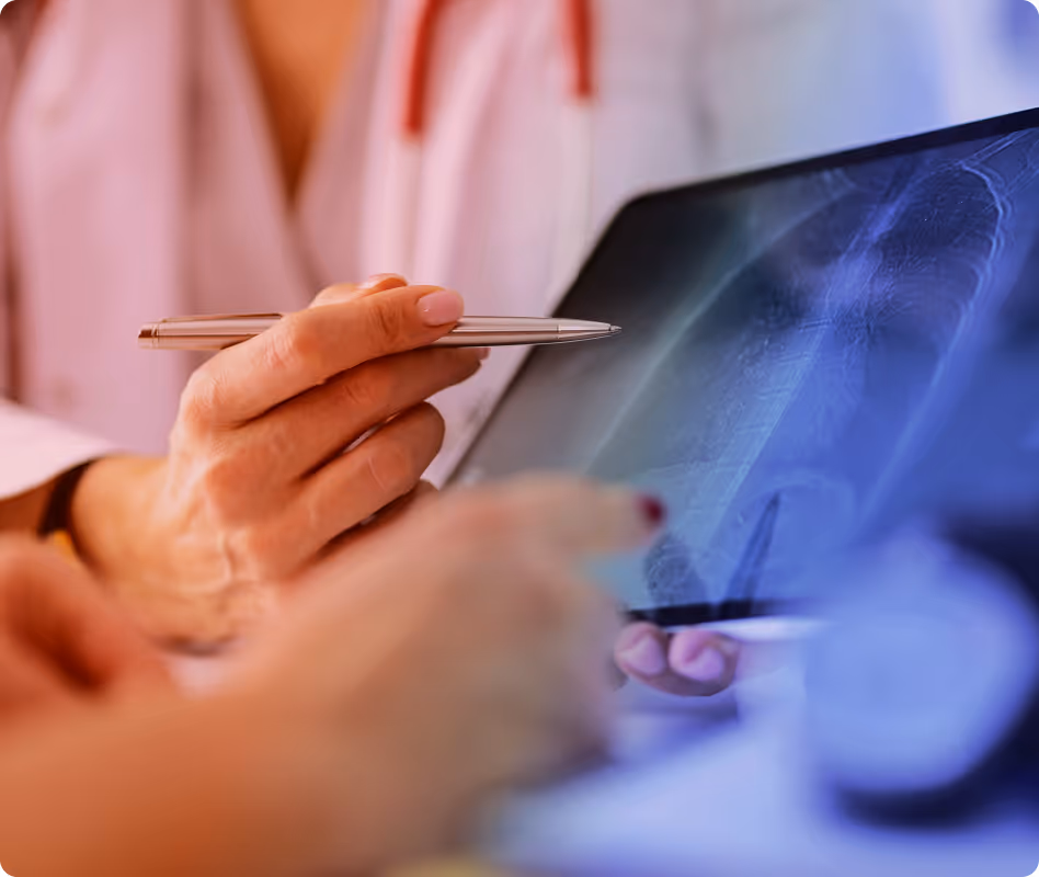 Doctor pointing at a chest X-ray on a tablet with a pen during a medical consultation.