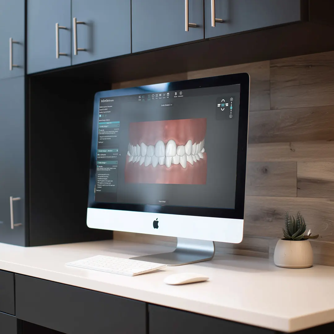apple computer showing the InSmile Smile Design Software
