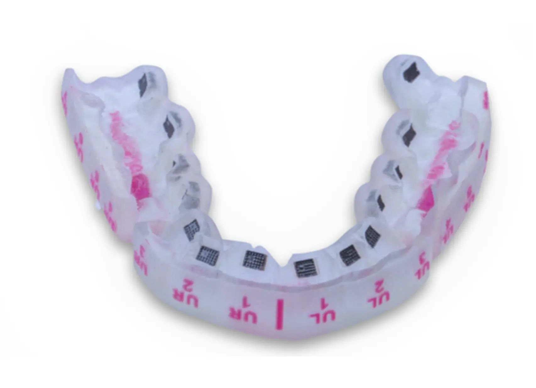 InSmile Braces IDB tray