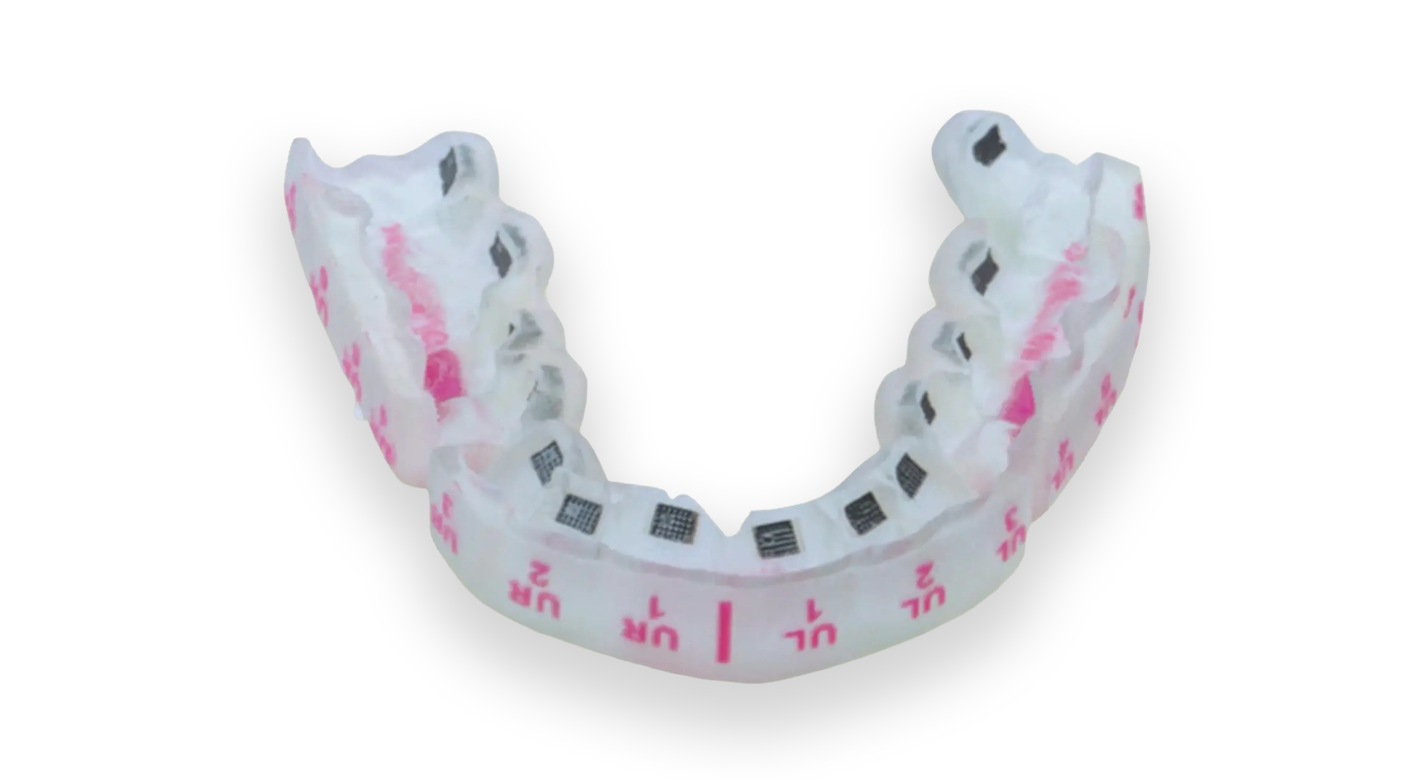 InSmile Braces IDB tray