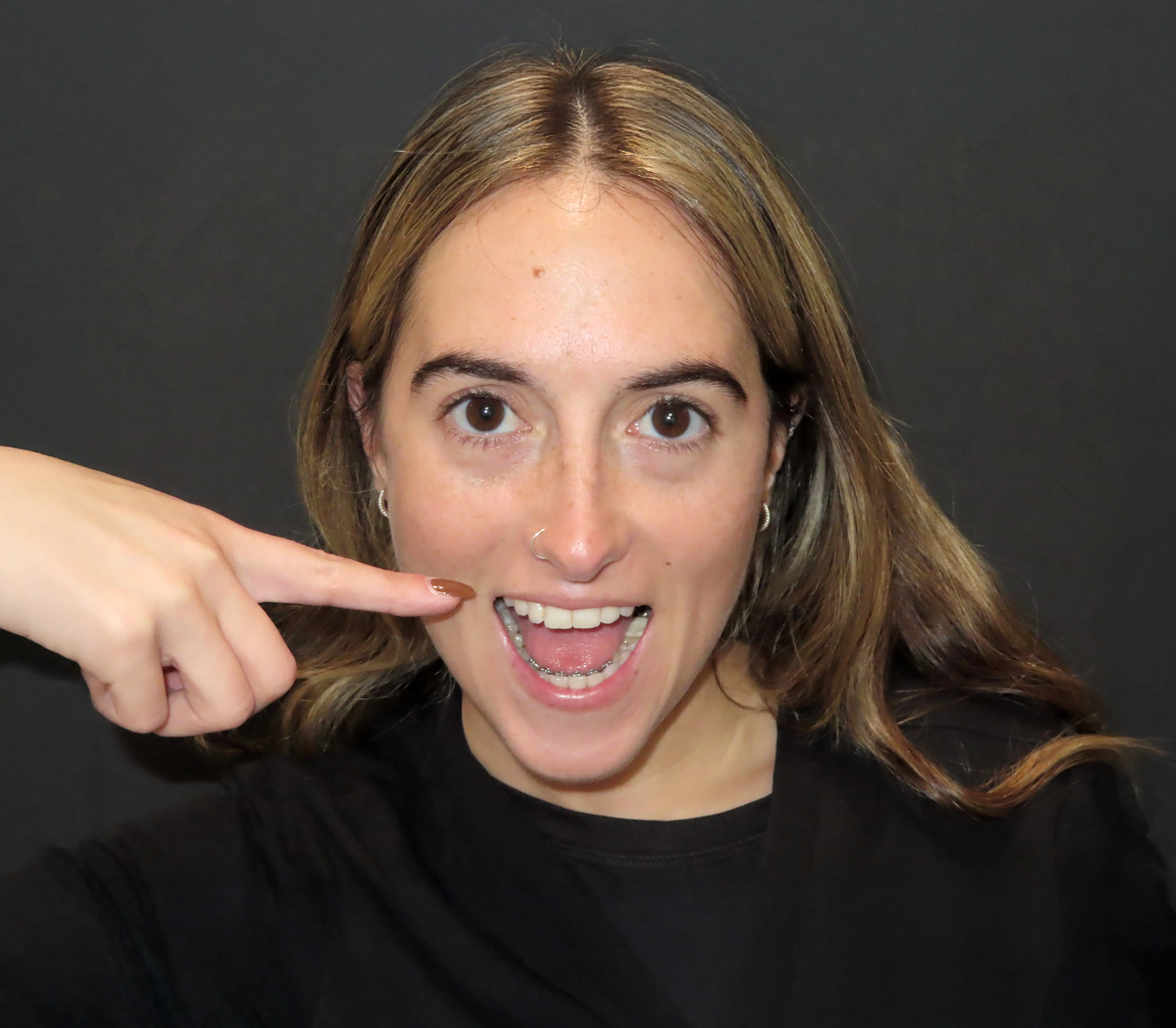young woman showing off her InSmile Braces