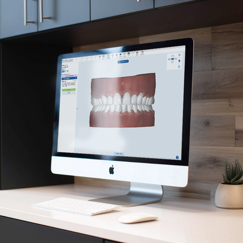 apple computer showing the InSmile Smile Design Software