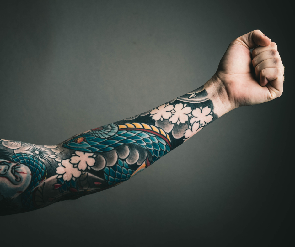 Tattoo Removal