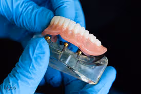 A person in blue gloves holding a fake tooth.