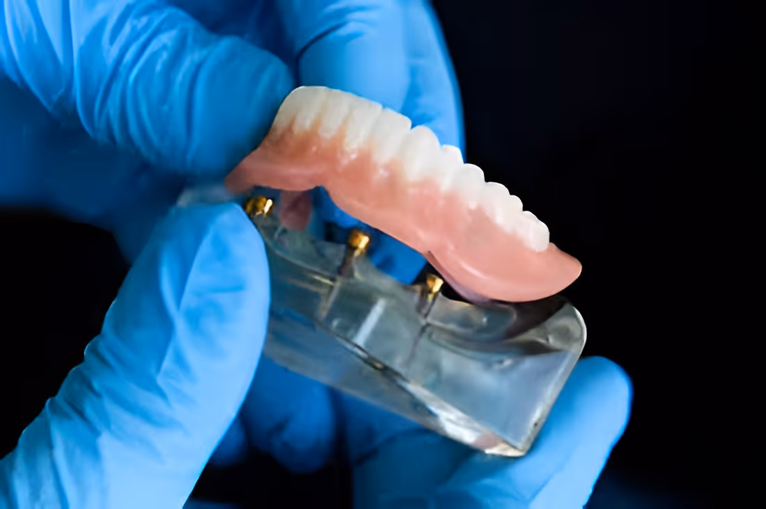 A person in blue gloves is holding a tooth.