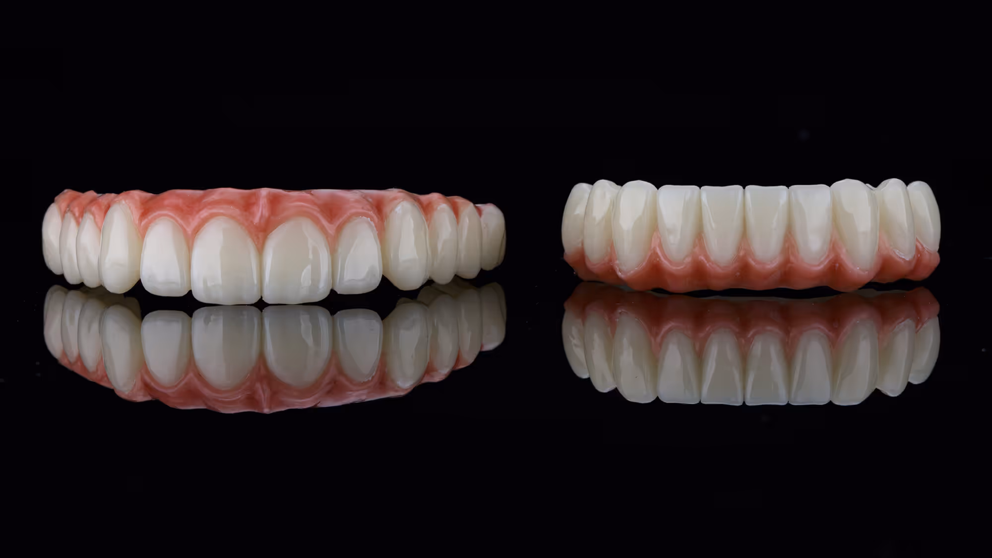 Zirconia Full Arch
