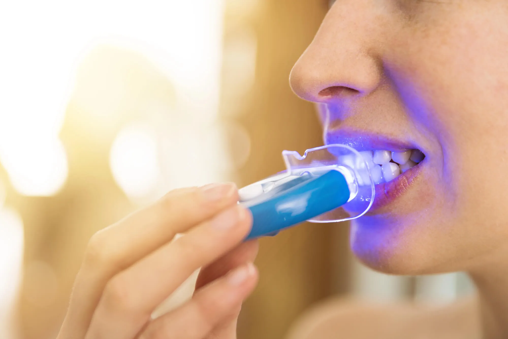 DIY teeth whitening malvern pa