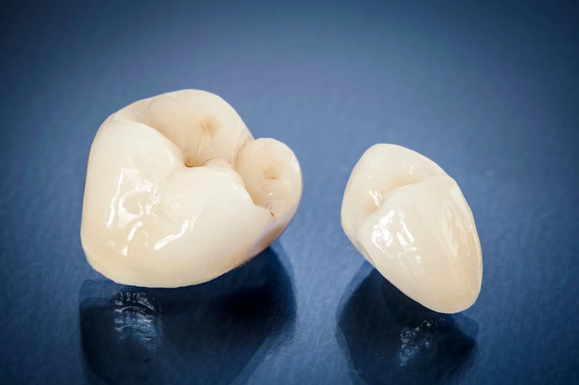sample of dental crowns malvern pa