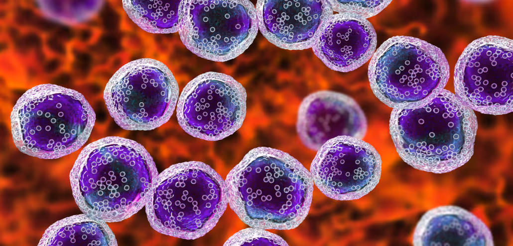 All About B-Cell Lymphoma