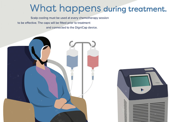 Scalp Cooling: Reduce Chemotherapy Hair Loss Effectively