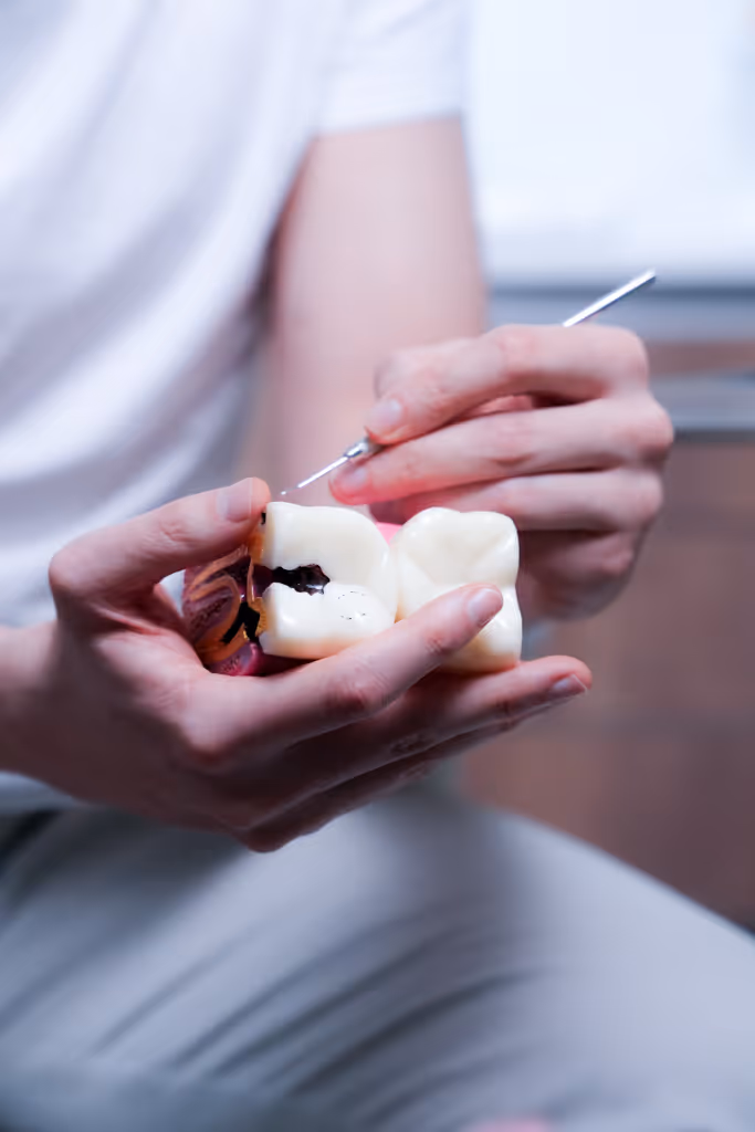 Person holding a dental model with cavities and pointing at it using a dental tool.