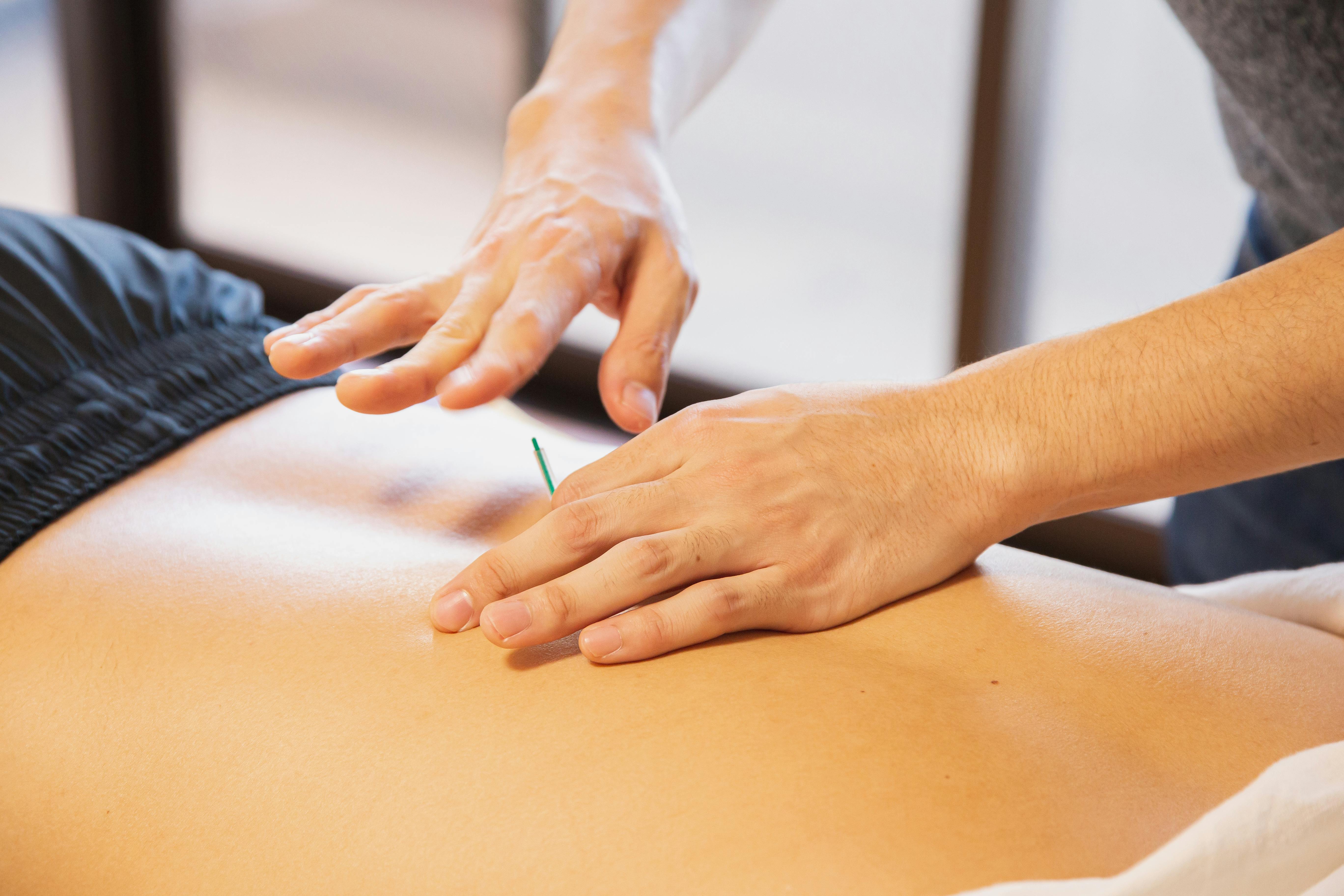hysiotherapist performing dry needling on a patient’s lower back to relieve muscle tension