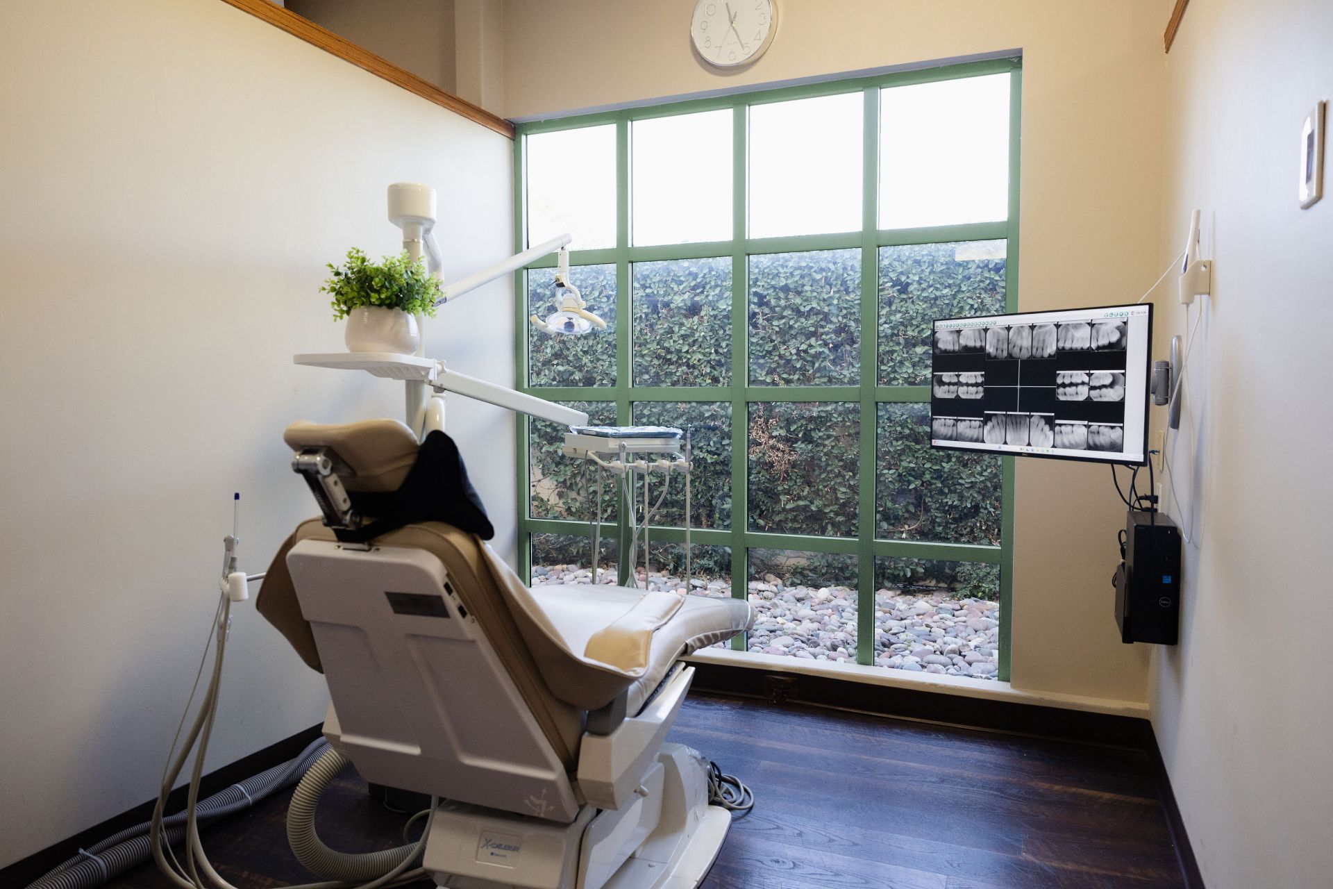 Dental treatment room at Ranunculus Dental in Carlsbad