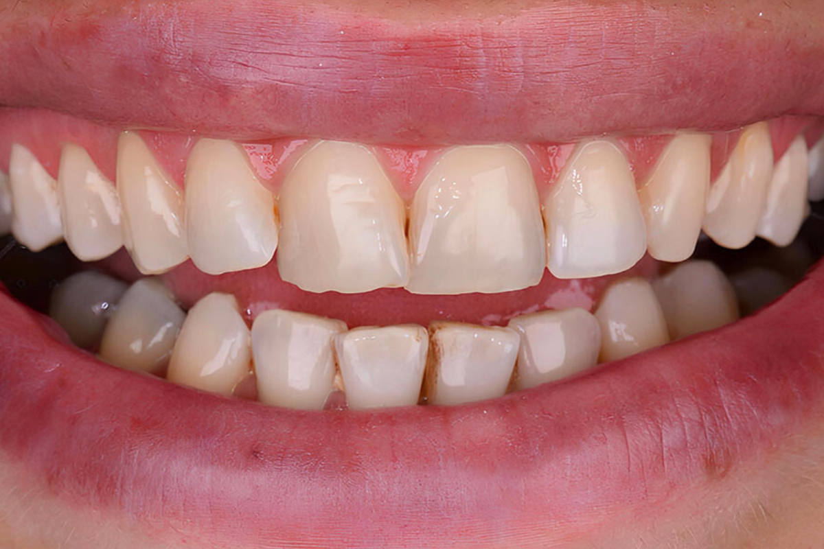 National Dental Implant Center of Hauppauge National Dental Implant Center of Hauppauge equipment and services in use in Hauppauge, NY