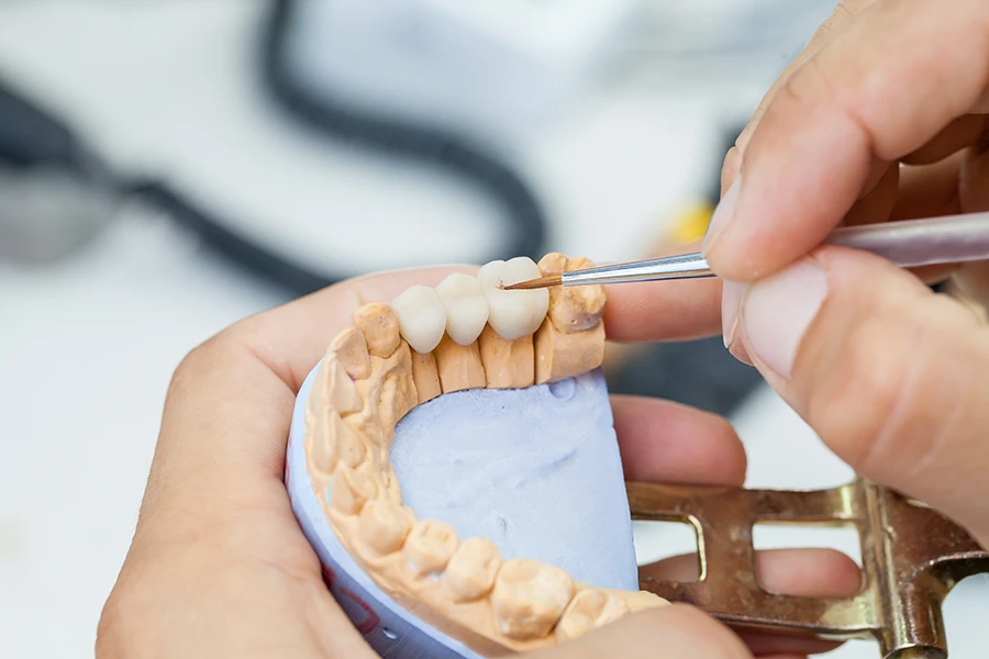 Close-up of hands holding a dental mold while painting a dental crown with a fine brush.