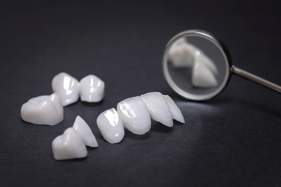 Dental veneers arranged on a dark surface with a magnifying glass reflecting some veneers.