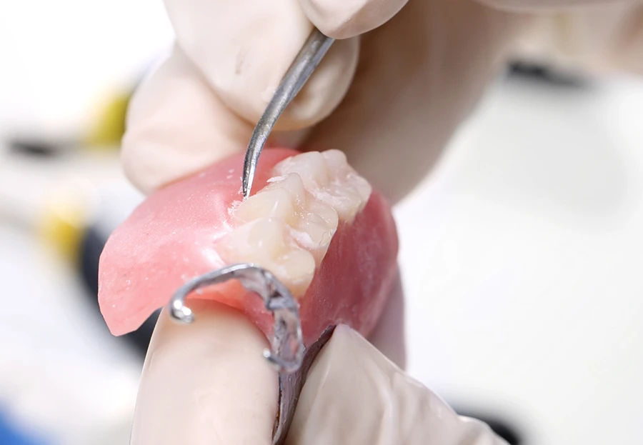Close-up of gloved hands adjusting artificial partial dentures with dental tool.